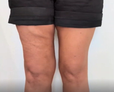 Magic Lift Skin Patches