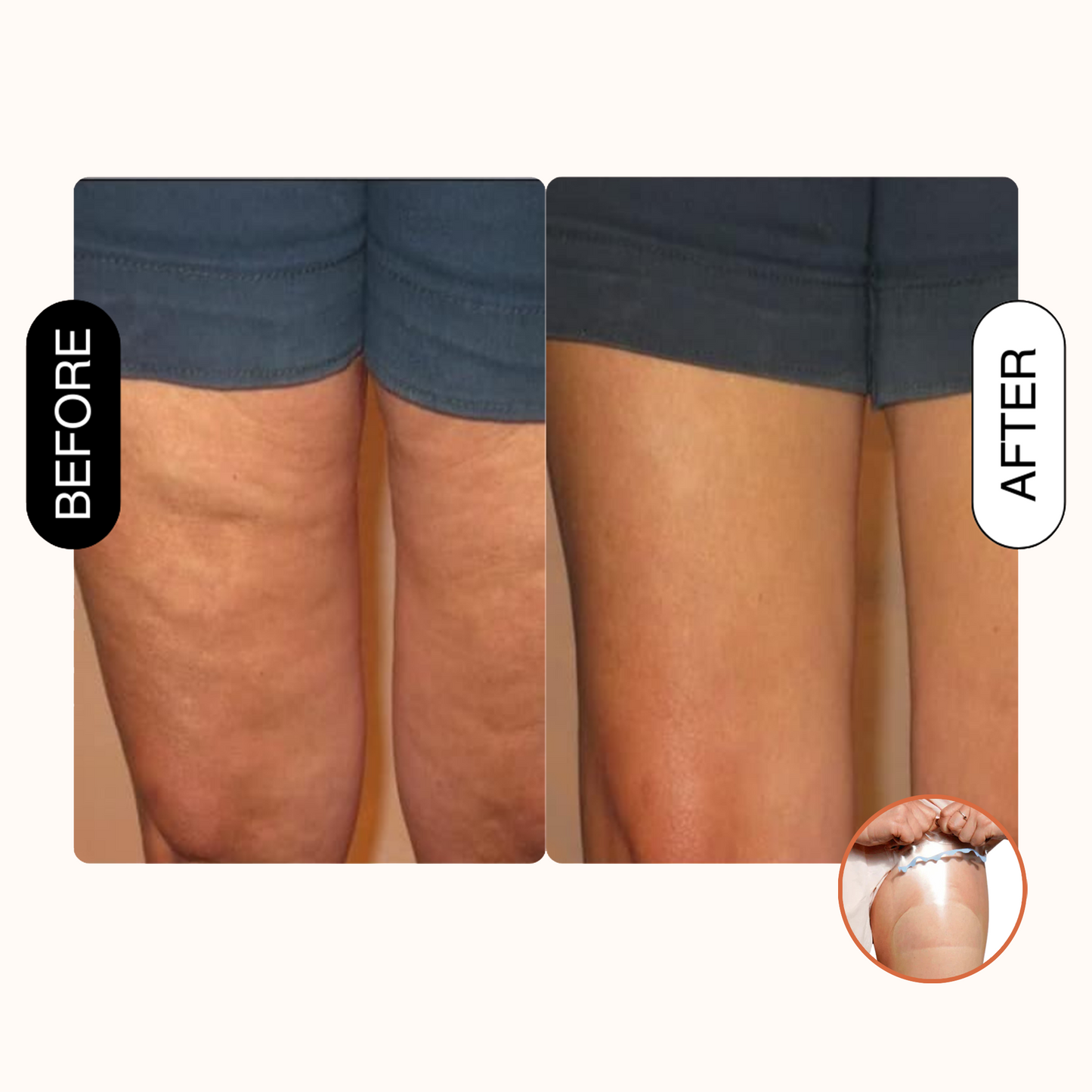 Magic Lift Skin Patches